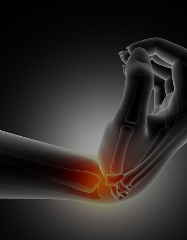 Bone Health visualization